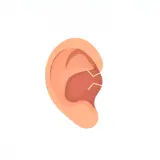 رسم توضيحي لكلمة earache